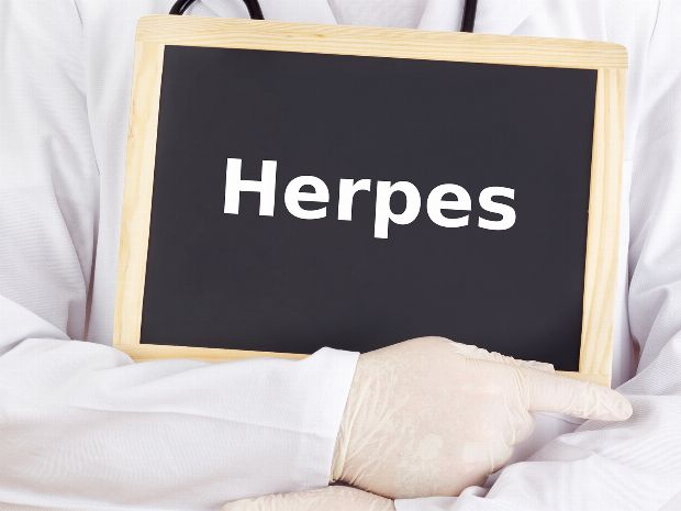 Genitaler Herpes Anzeichen And Behandlung 